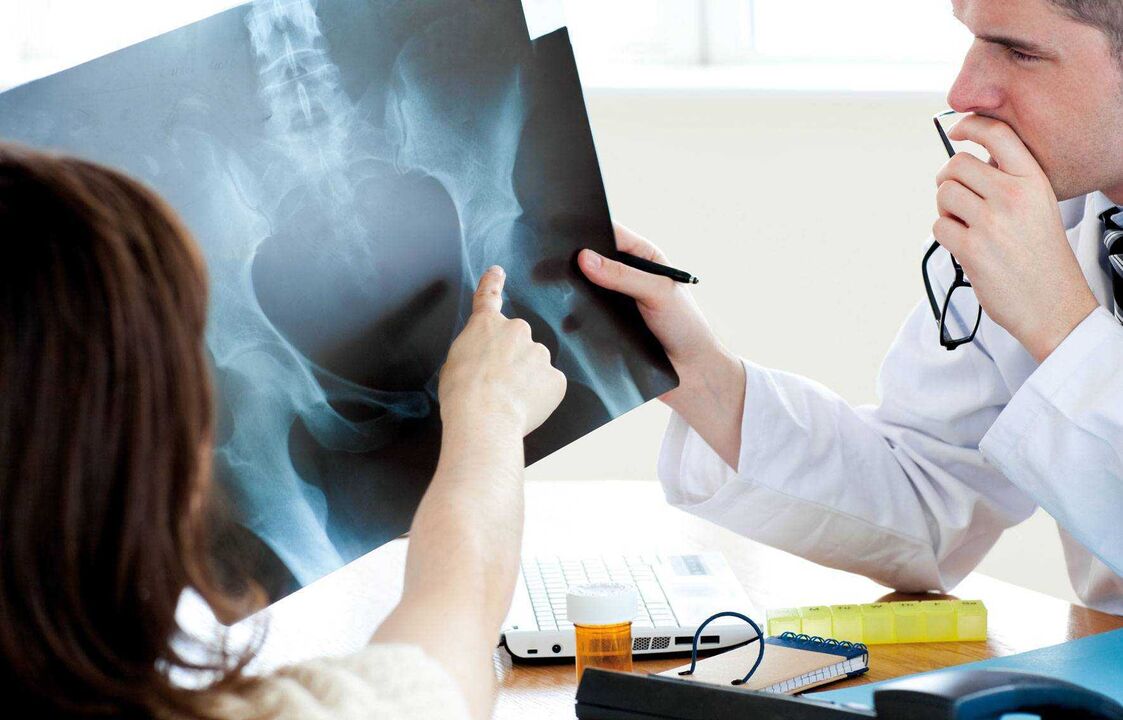 médicos que examinan la radiografía para la artrosis de cadera